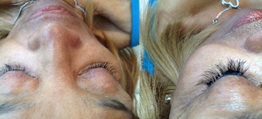 Before and After Eyelash Extensions 11